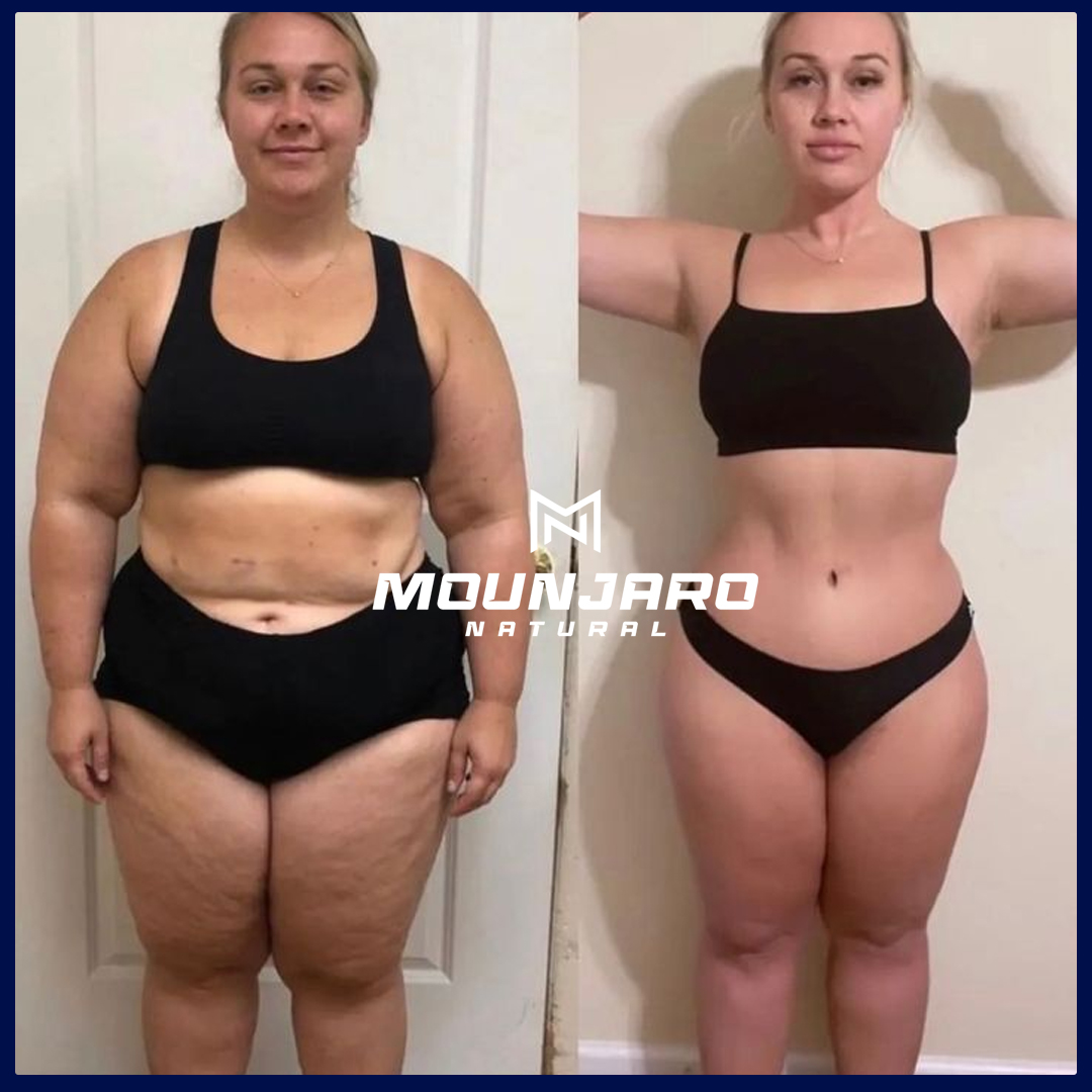 antes e depois 01